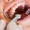 Rehabilitación-Oral